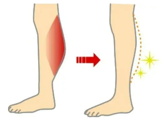 瘦小腿要对症下药